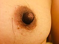 Hairy nipples