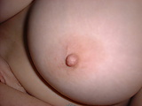breast1.JPG